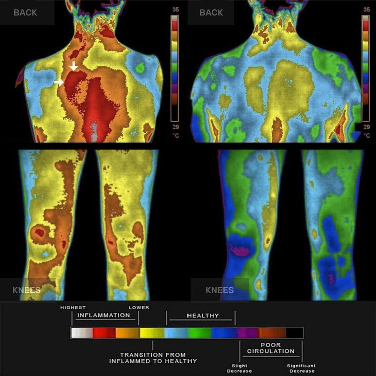 Thermal body scans showing inflammation and circulation levels indicated by varying colors from red to blue.