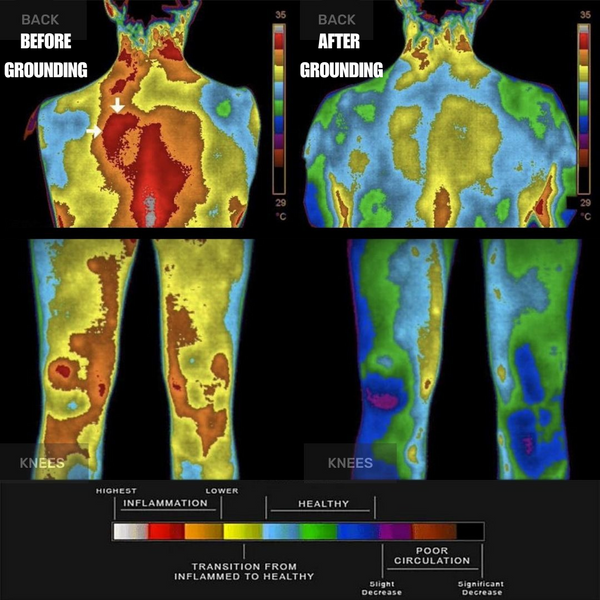 Reduces Inflammation